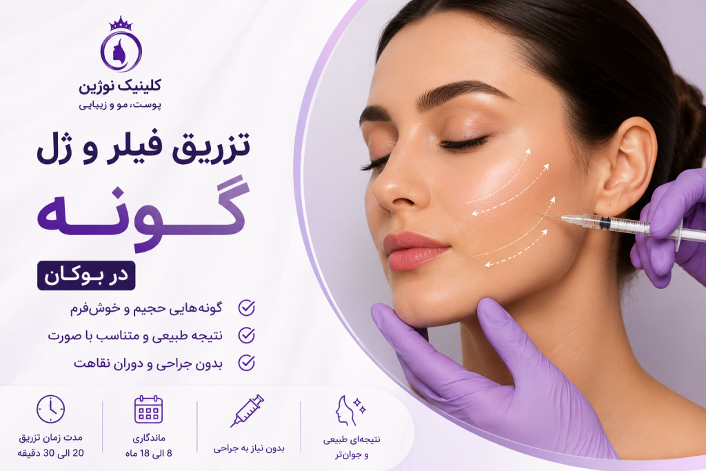 تزریق ژل گونه