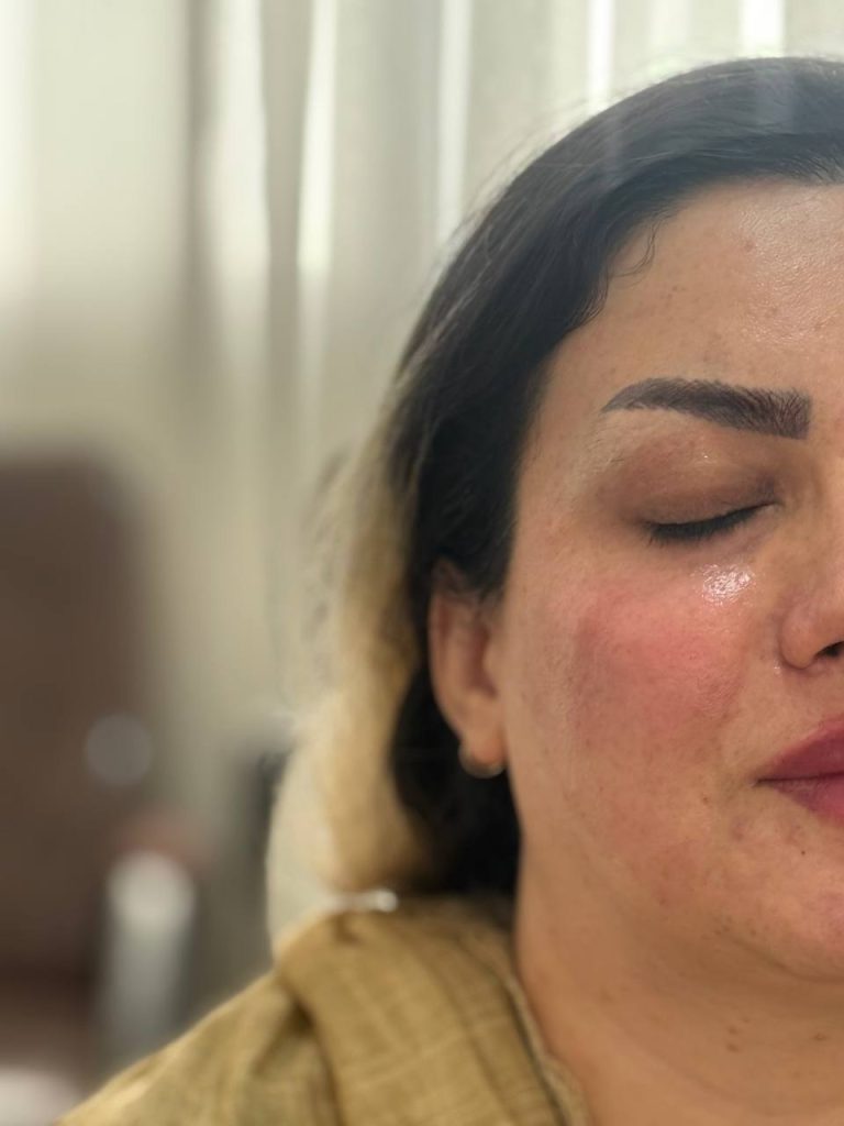 تزریق به روش روسی