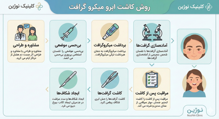 میکرو کاشت ابرو