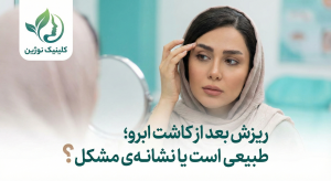 ریزش بعد از کاشت ابرو