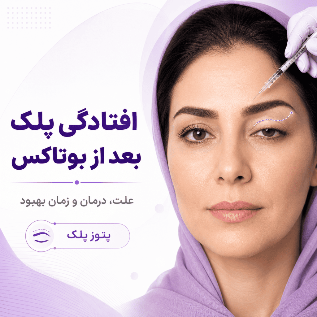 افتادگی پلک بعد از بوتاکس