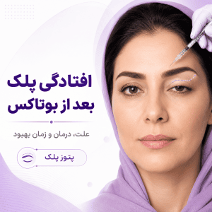 افتادگی پلک بعد از بوتاکس