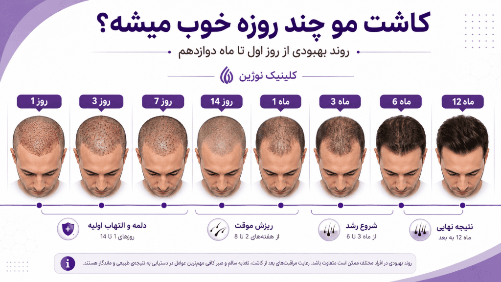 کاشت مو چند روزه خوب میشه؟